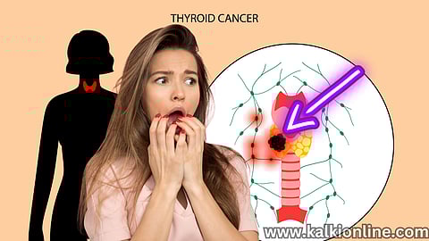 Symptoms of Thyroid Cancer.