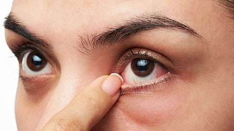 வறட்சியான கண்கள்