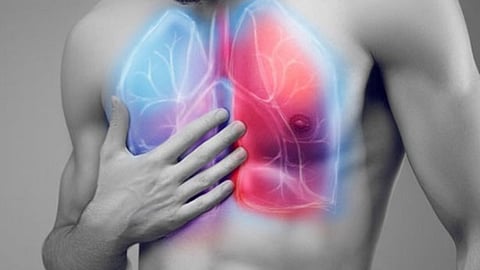 நுரையீரல் பிரச்னை