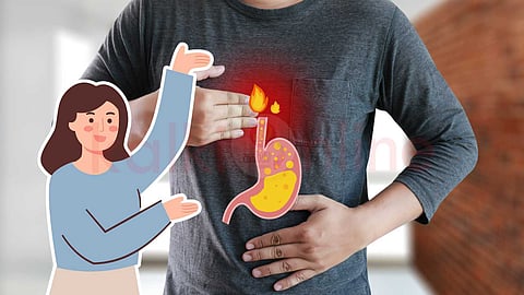 Heartburn and Acidity