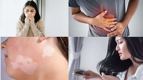 10 Useful Grandma Remedies