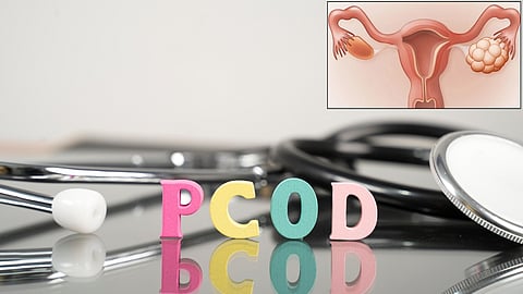 PCOD