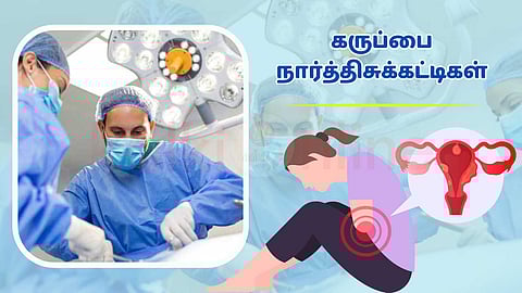 Uterine fibroids - Firm Hospitals