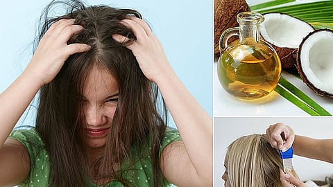 Want to get rid of lice? Try these products at home!