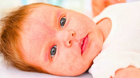 skin problems in children