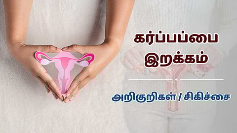 Uterine Prolapse treatment