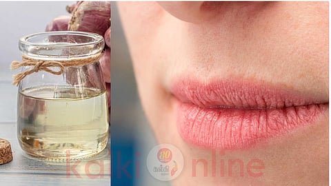 Get rid of chapped lips in winter