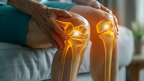 Bone deficiency