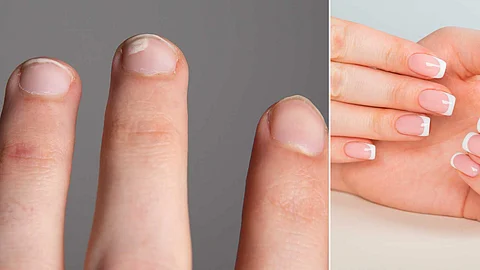 spot on fingernail