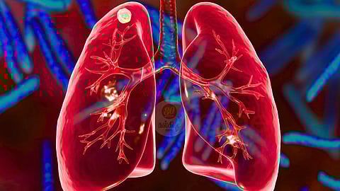 Lung scarring