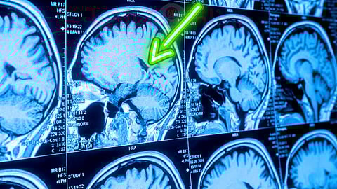 MRI