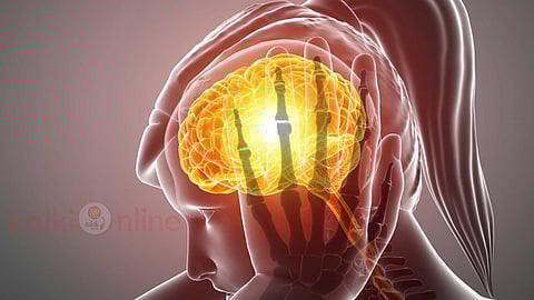 migraine