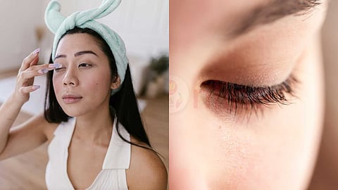 Saffron oil to remove dark circles!