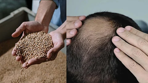 Ration wheat hair problem