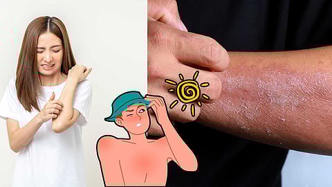 To deal with skin problems that occur in summer...