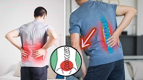 நாள்பட்ட முதுகு வலி