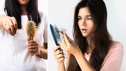 main causes of hair loss