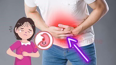 Ulcer