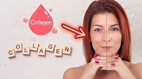 Collagen