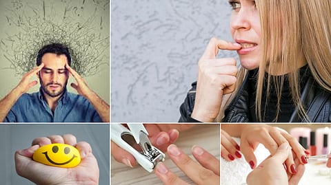 Nail biting habit
