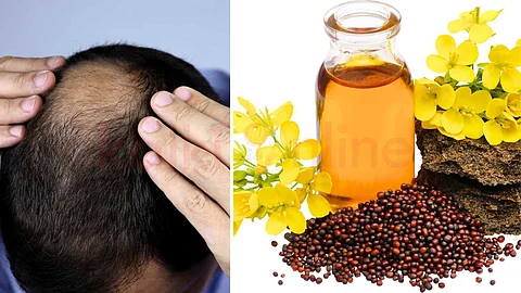 Mustard oil is enough for the problem of baldness!