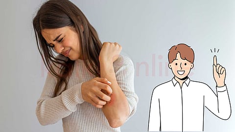 Sweat Dermatitis