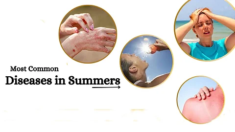 Common summer infections