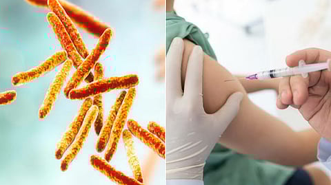 Micro bacterium tuberculosis