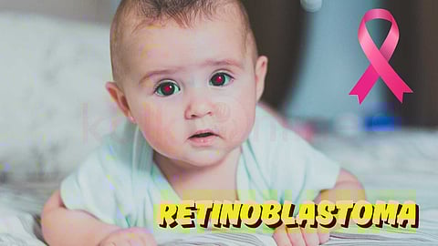 Retinoblastoma