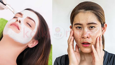 tips for oily skin care!