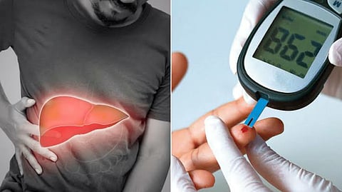 Liver damage due to diabetes