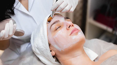 Chemical peel treatment