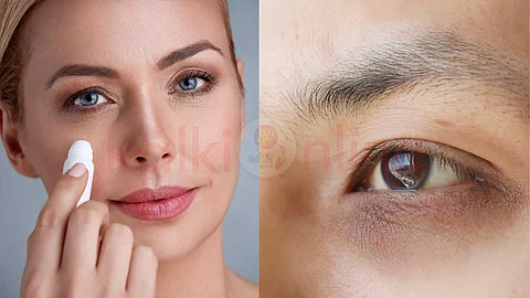 dark circles around the eyes!