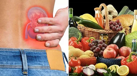 Foods for kidney stones