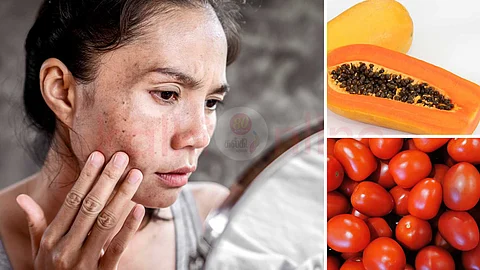 Tips for dark dots