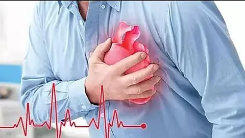 Heart attack
