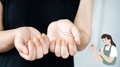 Nail disease symptoms
