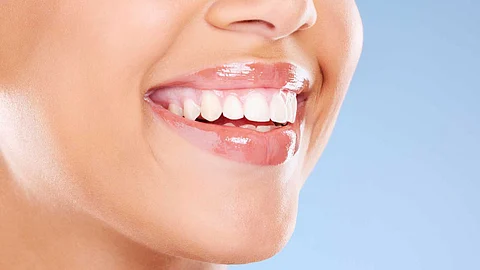 Ways to whiten teeth