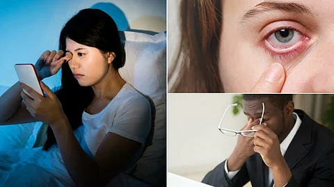 Eye problem