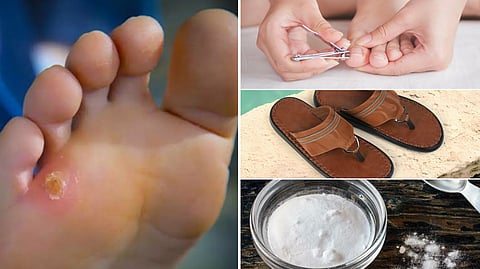 Callus remedies