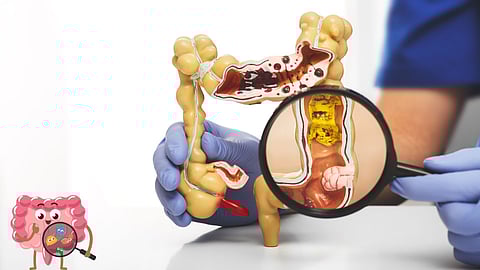 Colon hydrotherapy