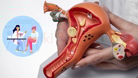 hysterectomy