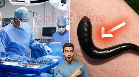 Leech treatment