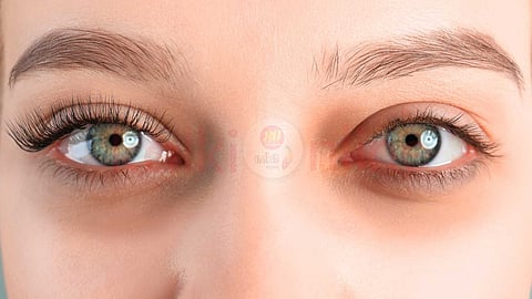 Dark circles under the eyes