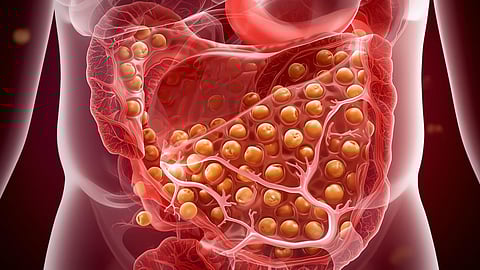 chickpeas harmful to the gallbladder
