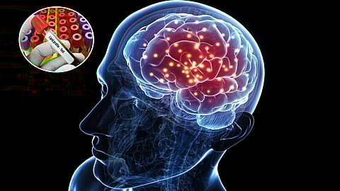 Lipid imbalance in brain