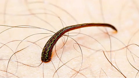 leeches - information you never knew before!
