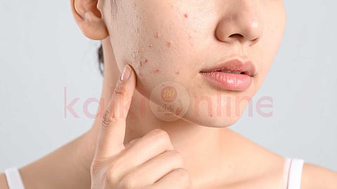 Beauty tips in tamil