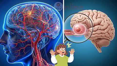 Aneurysms symptoms and cure