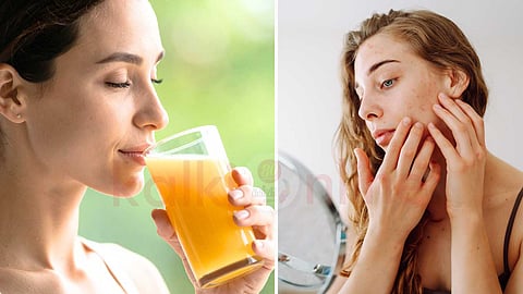 Natural beauty treatments